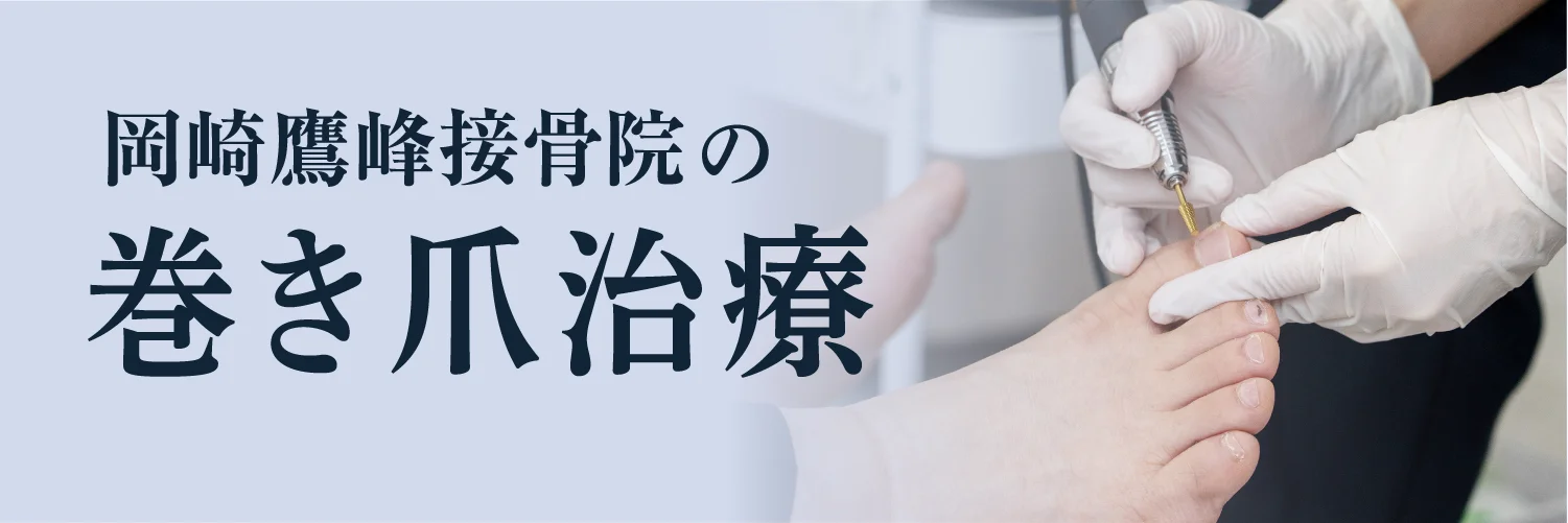 岡崎市の巻き爪矯正なら岡崎鷹峰接骨院