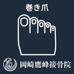 【岡崎市で陥入爪のお悩み】爪が肉に刺さって痛い！放置のリスクと「切らない」補正を解説